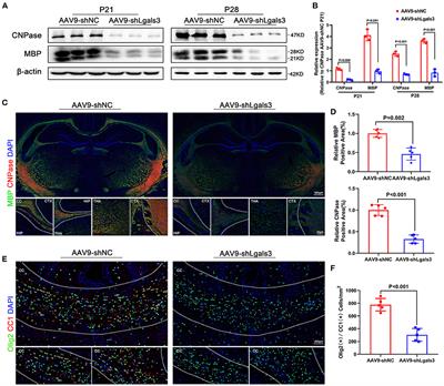 Galectin-3 administration drives remyelination after hypoxic-ischemic induced perinatal white matter injury